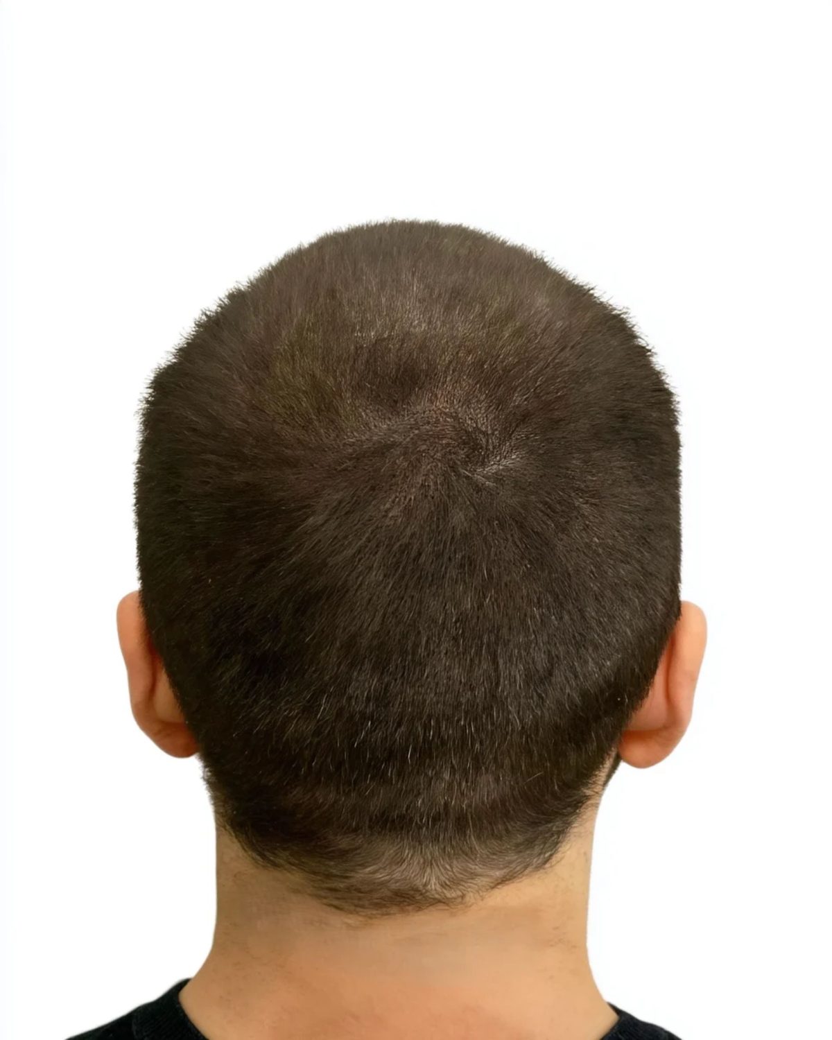 Density fill: after treatment